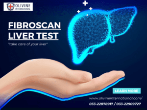 Fibroscan liver test